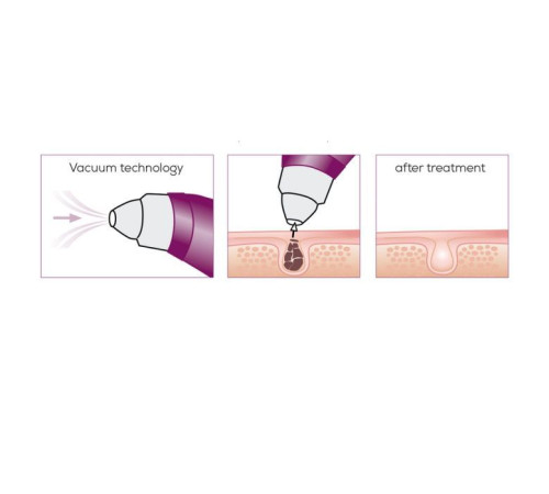 Массажер Beurer FC 41 (FC_41)